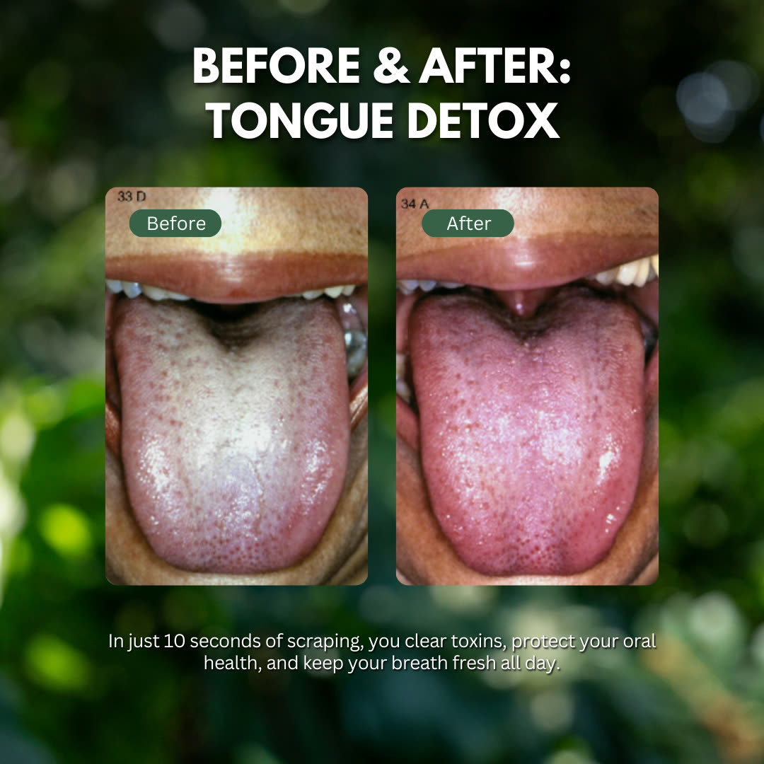 Before & after