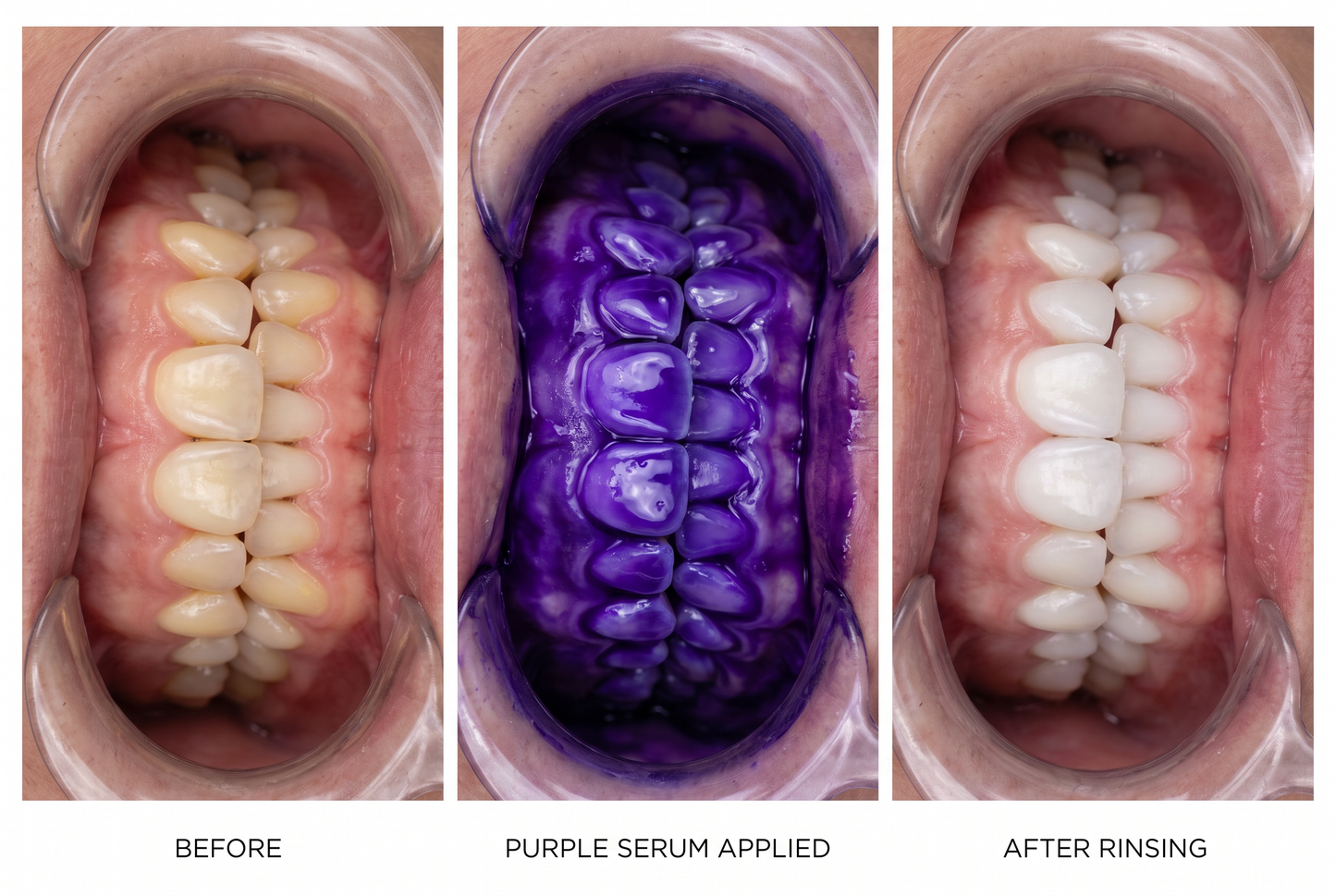 Before, purple serum applied, after rinsing