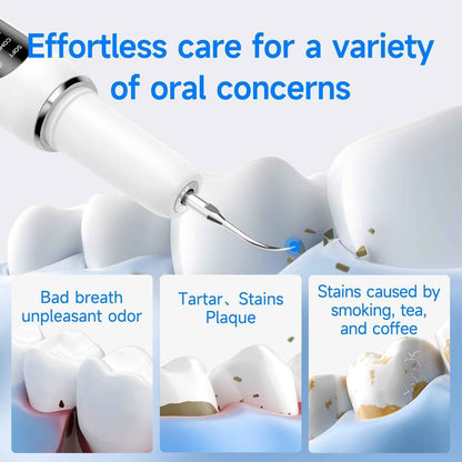 Ultrasonic Tooth Cleaner - Smart Dental Plaque Remover for Effective Oral Hygiene