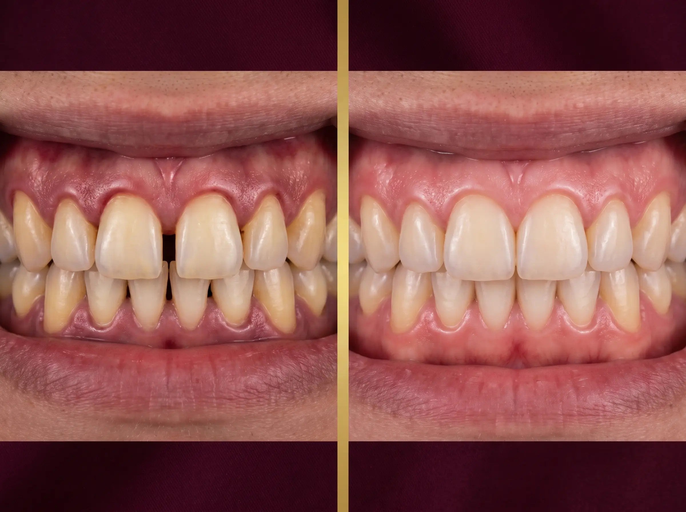 Before and after — Ji-Ho L.